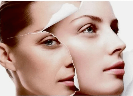Contraindicaciones para el avivamiento láser facial