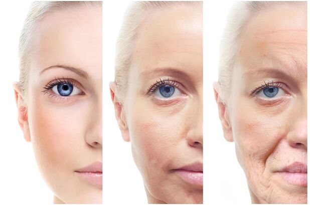 Eliminación láser de cambios faciales relacionados con la edad