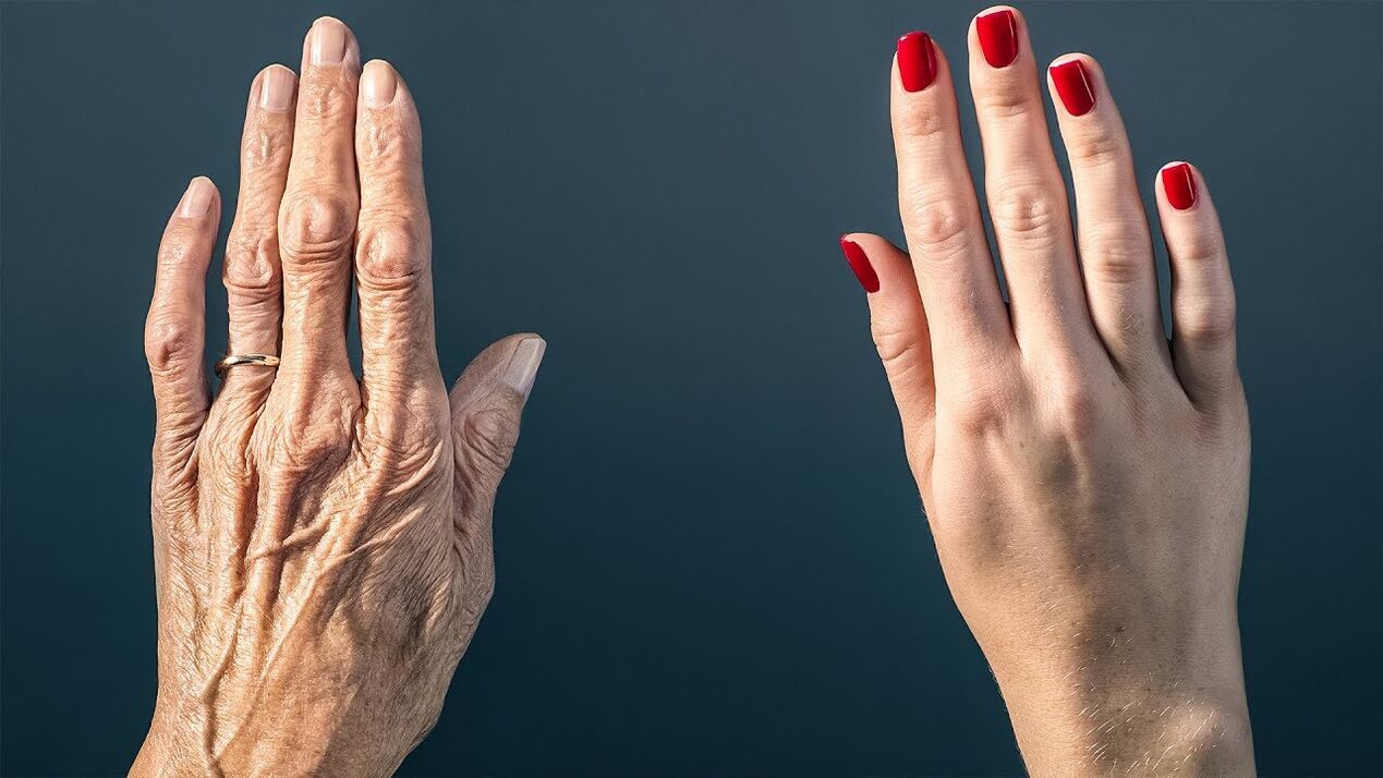 Formas efectivas de rejuvenecer la piel de tus manos.
