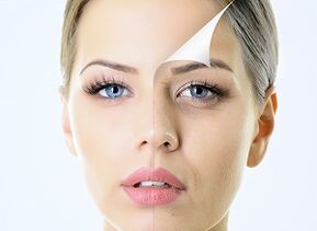 Cómo rejuvenecer la piel del contorno de ojos en casa.