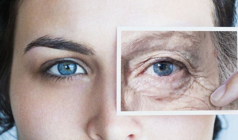 Formas de rejuvenecer la piel alrededor de los ojos