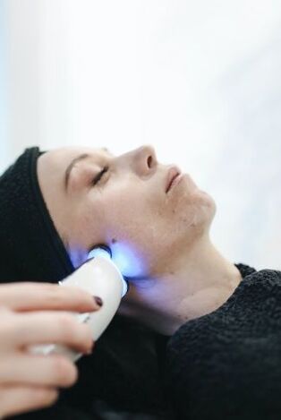 Rejuvenecimiento facial con láser